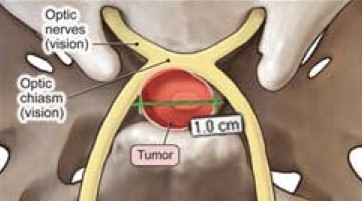 Pituitary Gland Illustration